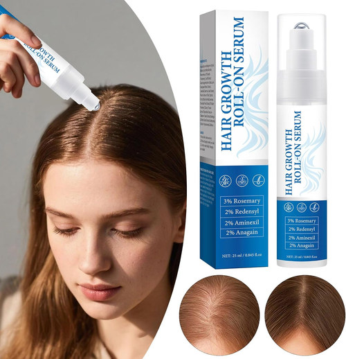 Rosemary hair growth roll-on serum for thicker, fuller hair; natural formula for quick absorption.